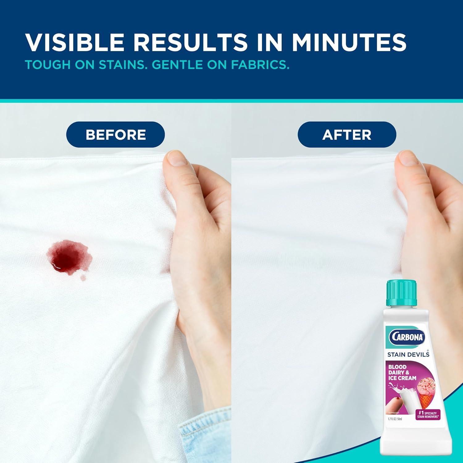 image:imageCarbona Stain Devils 4 Blood Dairy amp Ice Cream Professional Strength Laundry Stain Remover MultiFabric Cleaner Safe On Skin amp Washable Fabrics 17 Fl Oz 3 PackBlood Dairy Ice cream